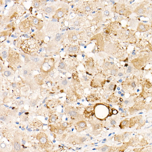 Perilipin-2 Rabbit monoclonal antibody