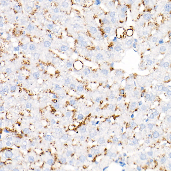 Perilipin-2 Rabbit monoclonal antibody