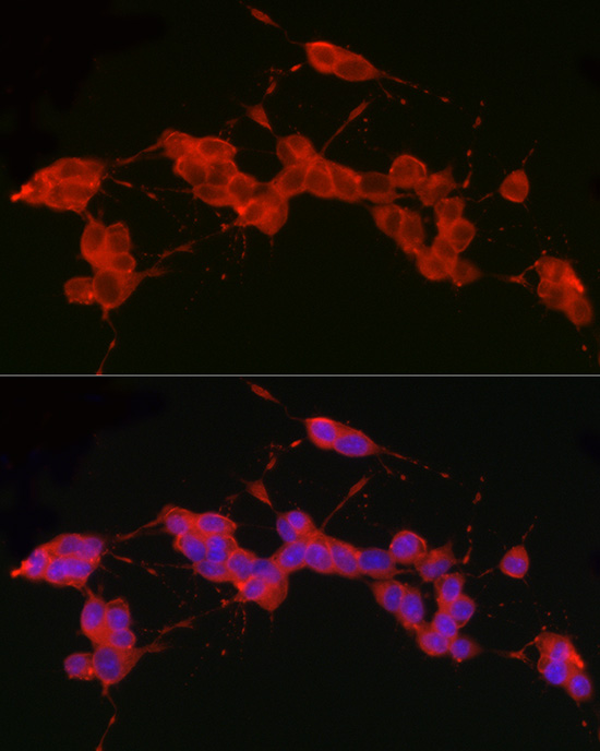 Ret Rabbit monoclonal antibody