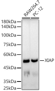 [KO Validated] XIAP Rabbit monoclonal antibody