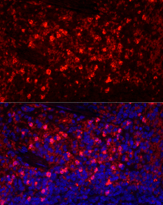 Ly-6G Rabbit polyclonal antibody