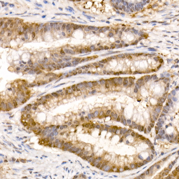 Bag1 Rabbit monoclonal antibody