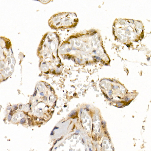 Bag1 Rabbit monoclonal antibody