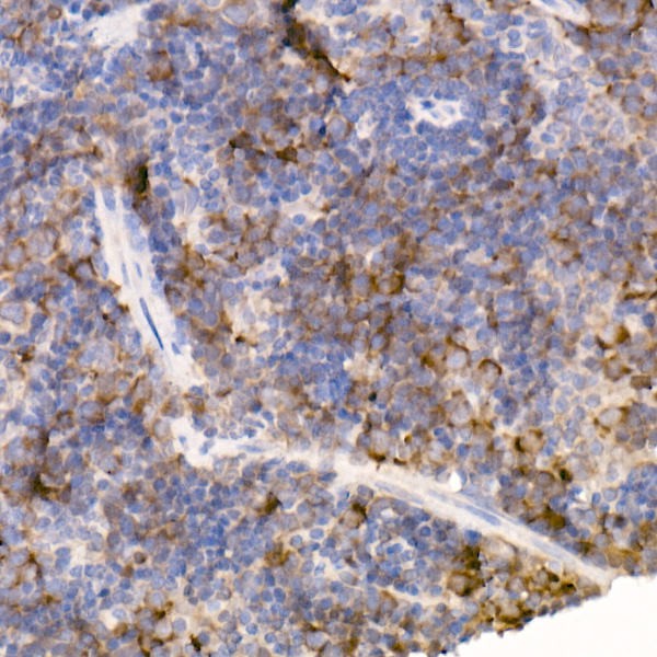 Bag1 Rabbit monoclonal antibody