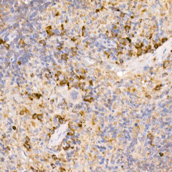 Bag1 Rabbit monoclonal antibody
