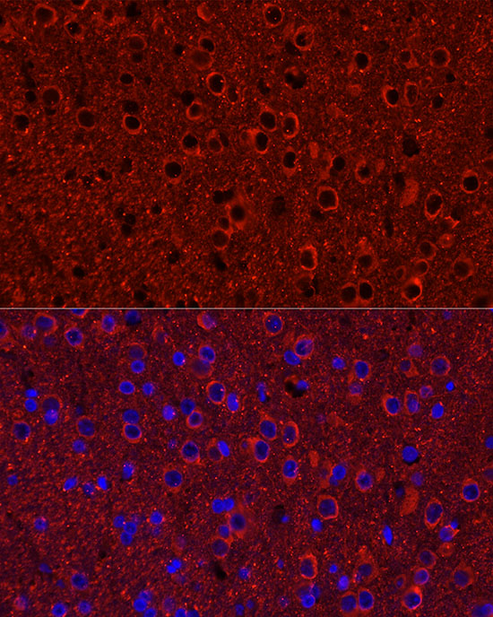 P2Y12 Rabbit monoclonal antibody