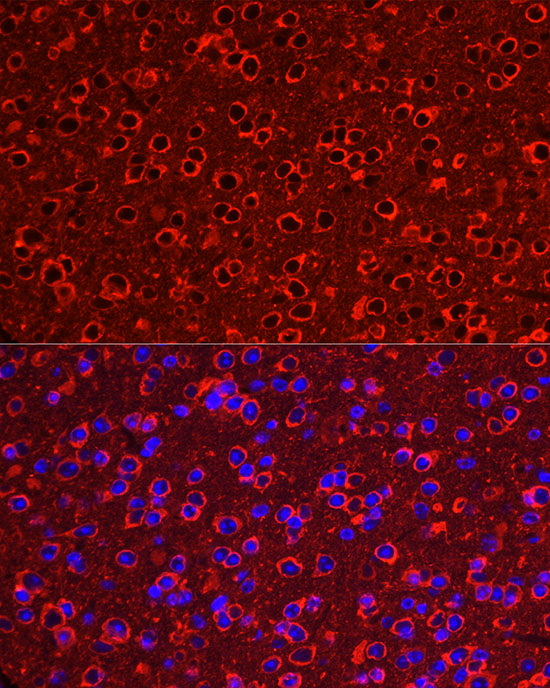 P2Y12 Rabbit monoclonal antibody