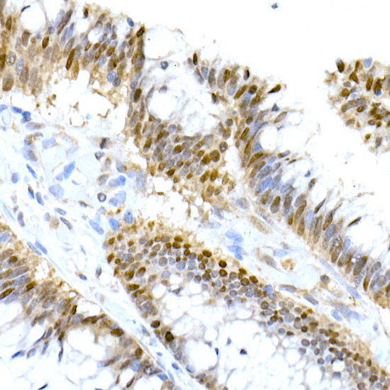 HNF-4-alpha Rabbit monoclonal antibody