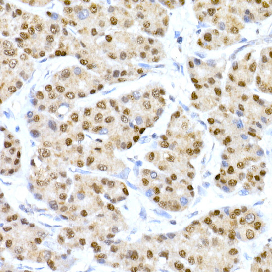 HNF-4-alpha Rabbit monoclonal antibody