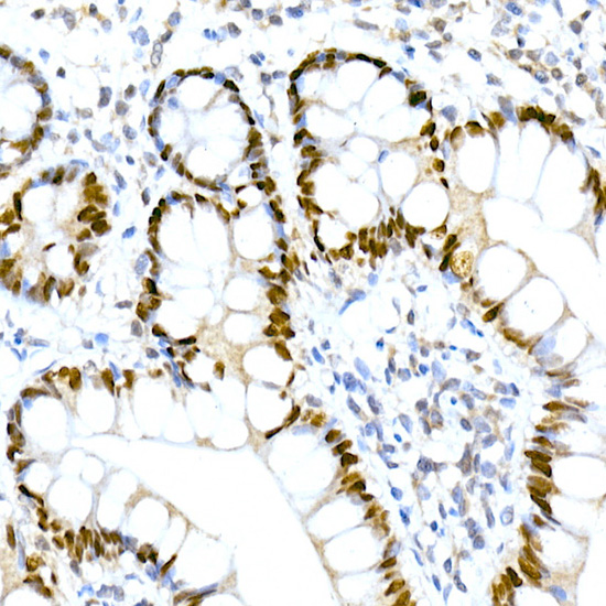 HNF-4-alpha Rabbit monoclonal antibody