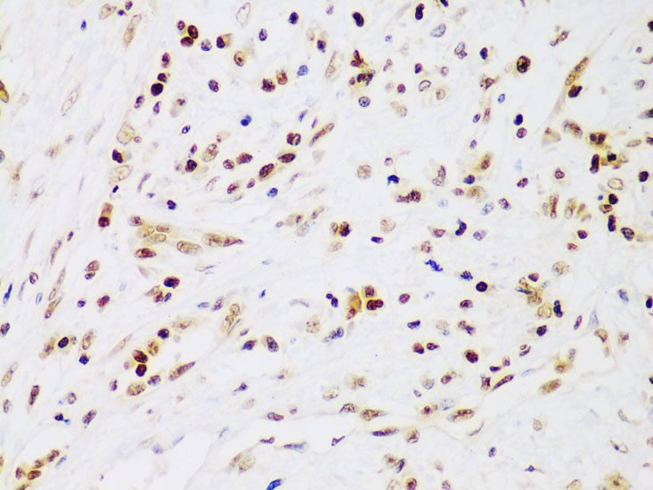 IKKB Beta Rabbit polyclonal antibody