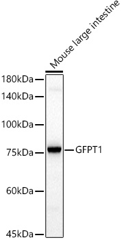 GFPT1 Rabbit monoclonal antibody