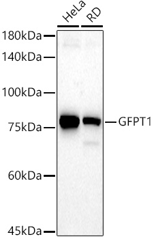 GFPT1 Rabbit monoclonal antibody