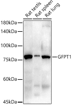 GFPT1 Rabbit monoclonal antibody