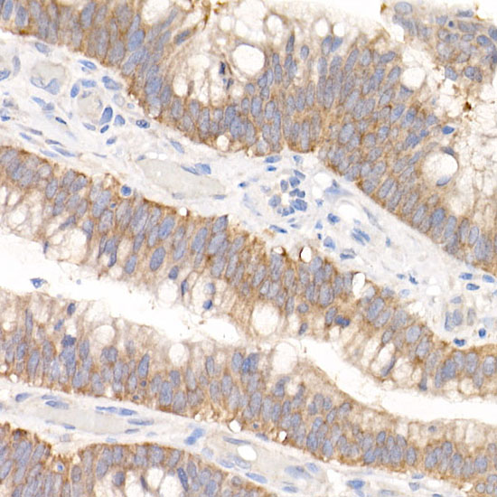GFPT1 Rabbit monoclonal antibody