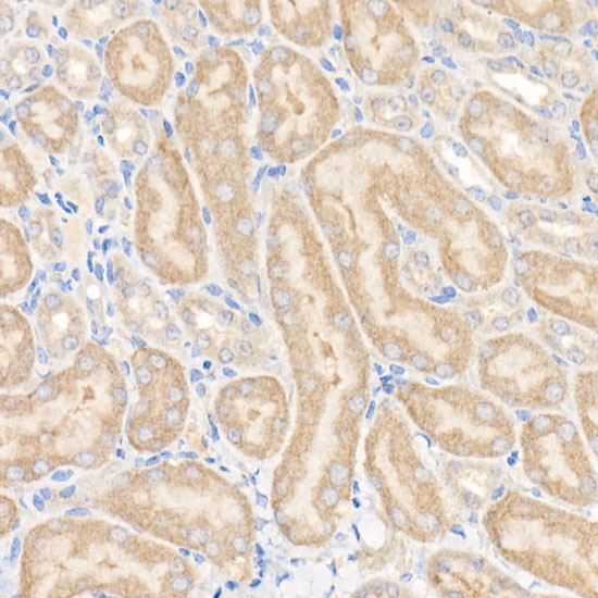 GFPT1 Rabbit monoclonal antibody