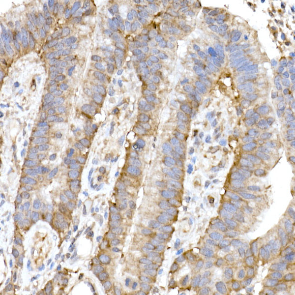 MAP3K4 Rabbit monoclonal antibody
