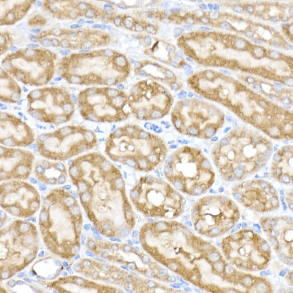 MAP3K4 Rabbit monoclonal antibody