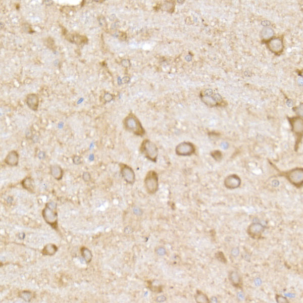 MAP3K4 Rabbit monoclonal antibody
