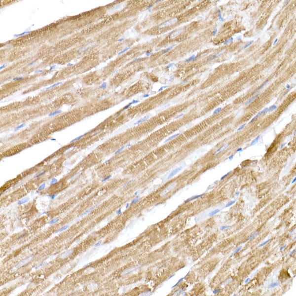 MAP3K4 Rabbit monoclonal antibody