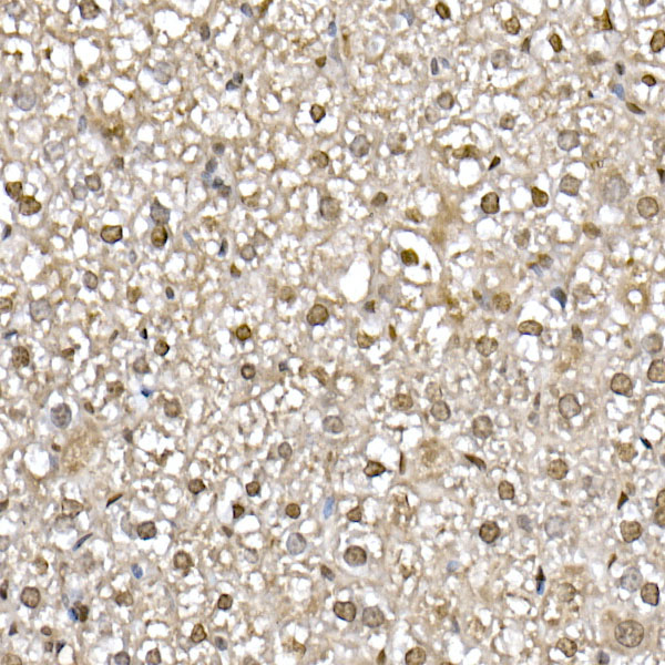 UBA52 Rabbit monoclonal antibody