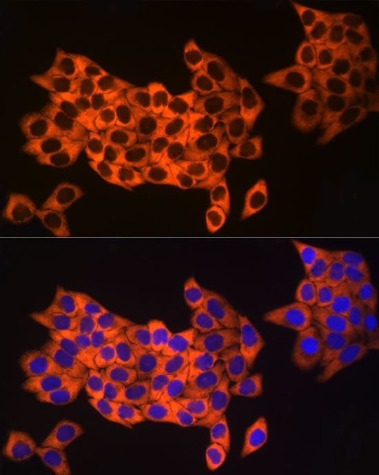 UBA52 Rabbit monoclonal antibody