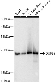 NDUFB9 Rabbit monoclonal antibody