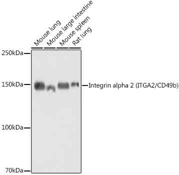NDUFB9 Rabbit monoclonal antibody