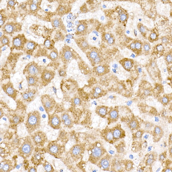NDUFB9 Rabbit monoclonal antibody
