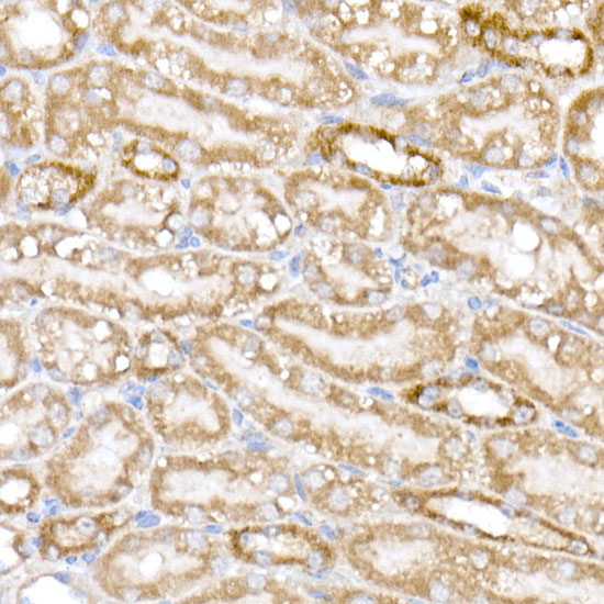 NDUFB9 Rabbit monoclonal antibody