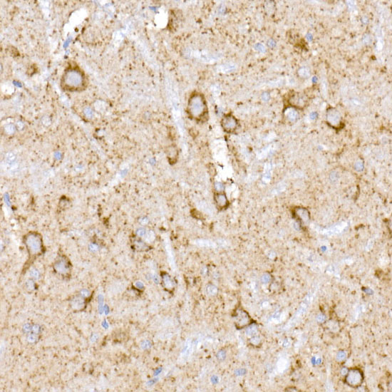 NDUFB9 Rabbit monoclonal antibody