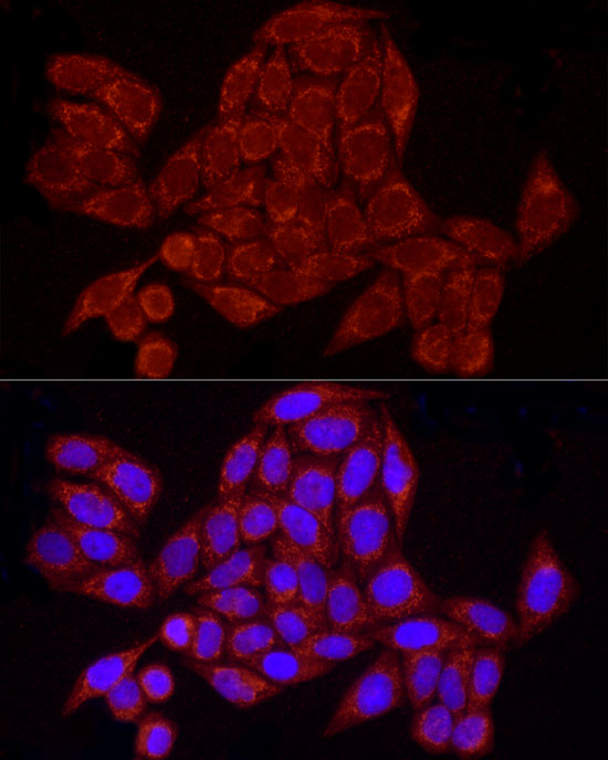GRSF1 Rabbit monoclonal antibody
