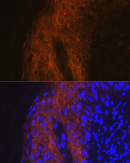 IL1RA Rabbit polyclonal antibody