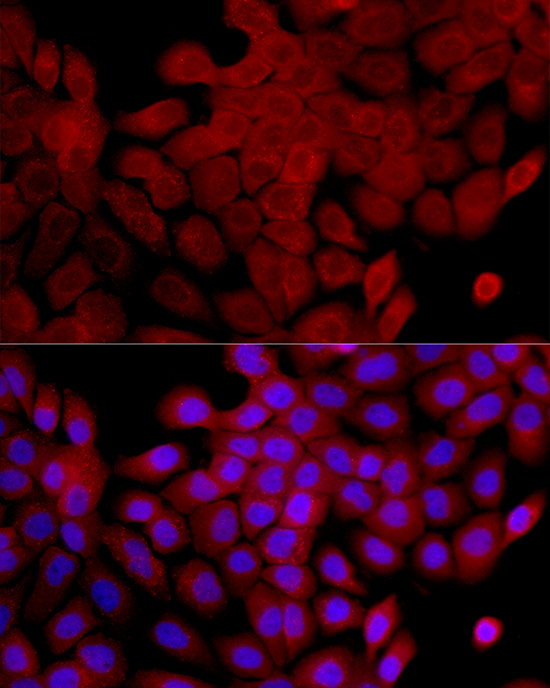 IL1RA Rabbit polyclonal antibody