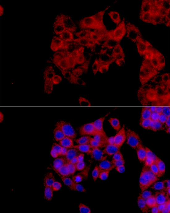 IL1RA Rabbit polyclonal antibody