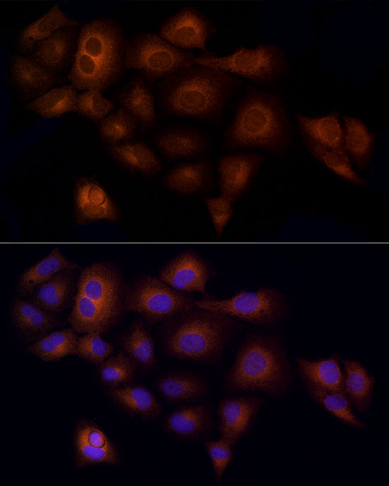 RAB5C / RABL Rabbit monoclonal antibody