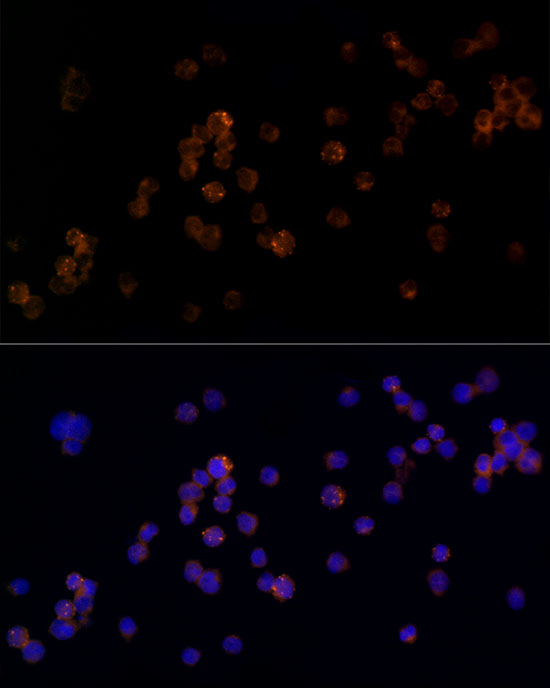 RAB5C / RABL Rabbit monoclonal antibody