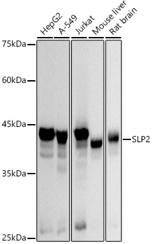 SLP2 Rabbit monoclonal antibody