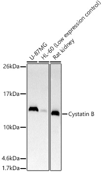 Cystatin B Rabbit monoclonal antibody