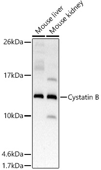 Cystatin B Rabbit monoclonal antibody
