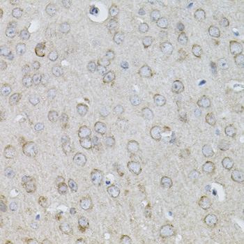 IL13 Rabbit polyclonal antibody