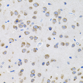 IL13 Rabbit polyclonal antibody