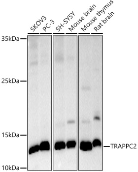 TRAPPC2 Rabbit monoclonal antibody