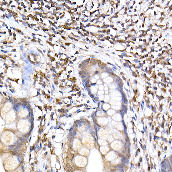 TRAPPC2 Rabbit monoclonal antibody
