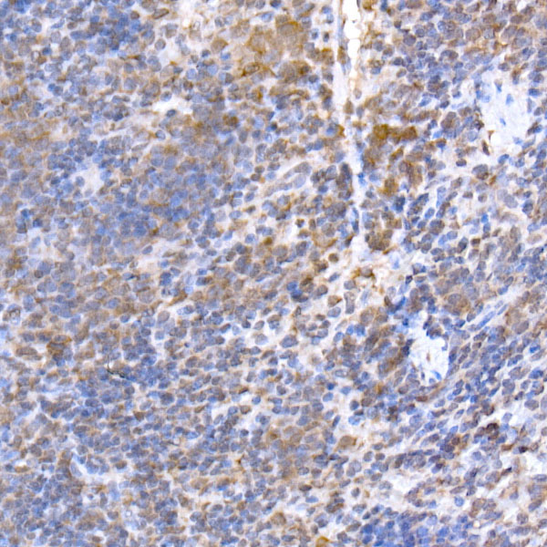 TRAPPC2 Rabbit monoclonal antibody