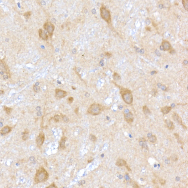 TRAPPC2 Rabbit monoclonal antibody