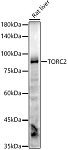 Western blot - TORC2 Rabbit mAb (A20893)