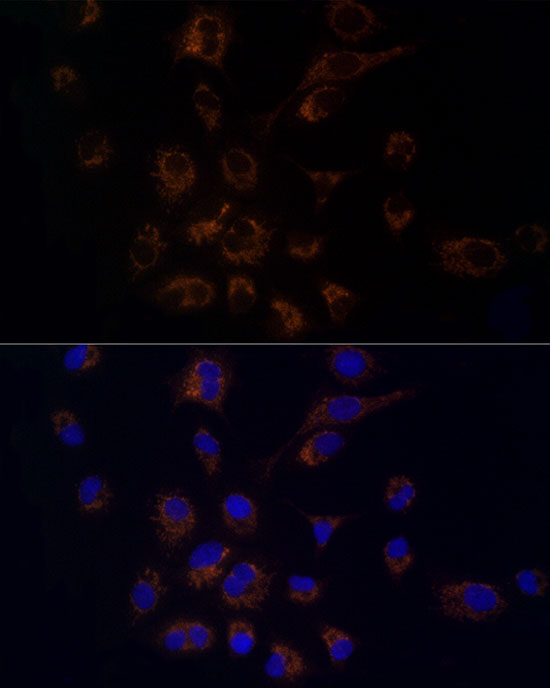 FDX1/ADX Rabbit monoclonal antibody