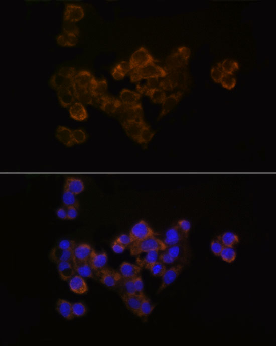 FDX1/ADX Rabbit monoclonal antibody