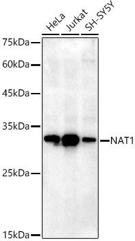 NAT1 Rabbit monoclonal antibody
